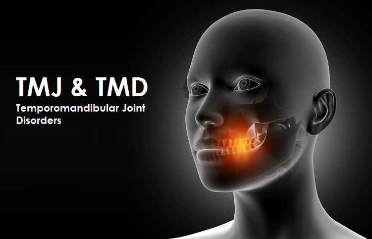 TMJ Disorders