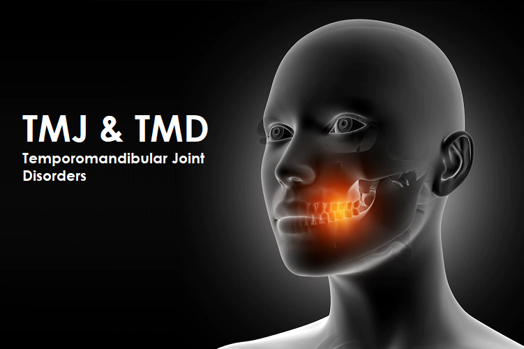 TMJ Disorders