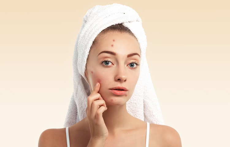 facial redness
