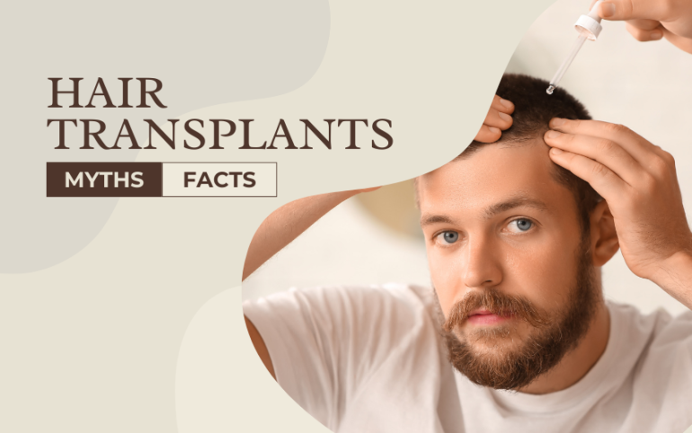 Hair Transplants Myths and Facts