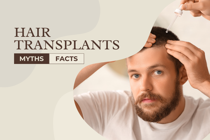 Hair Transplants Myths and Facts