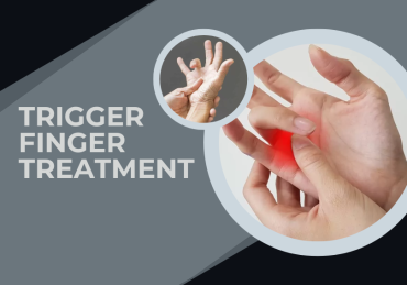 trigger finger treatment