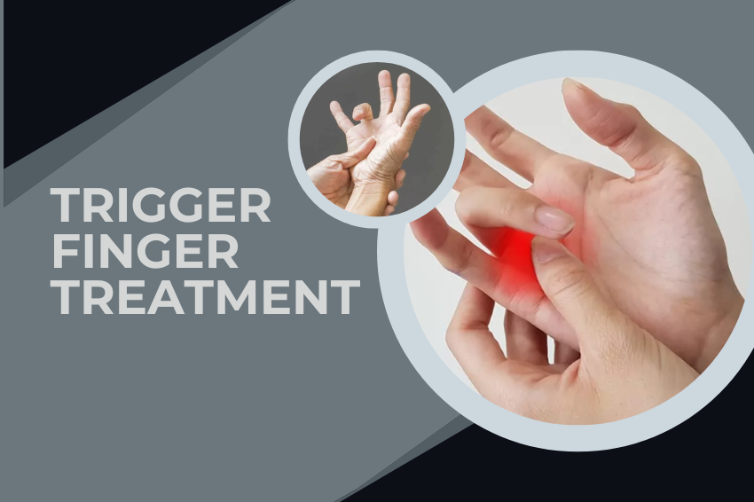 trigger finger treatment
