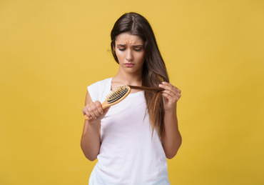 Hair Loss in Women